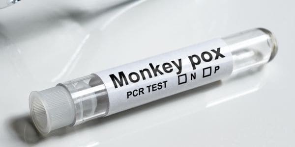 Gautenger sterf aan apokke